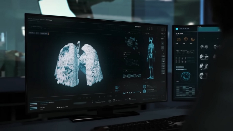 A medical scan displayed on computer monitors illustrates the role of responsible and regulated AI in healthcare