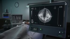 A patient lies in a hospital bed while a monitor shows detailed scans used in modern healthcare diagnostics