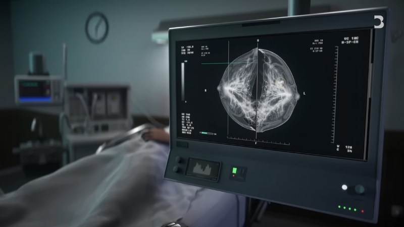 A patient lies in a hospital bed while a monitor shows detailed scans used in modern healthcare diagnostics