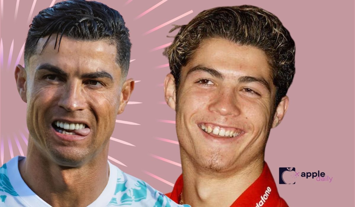 Side by side images of Cristiano Ronaldo early in his career and later as a professional football star, highlighting changes in his teeth and smile