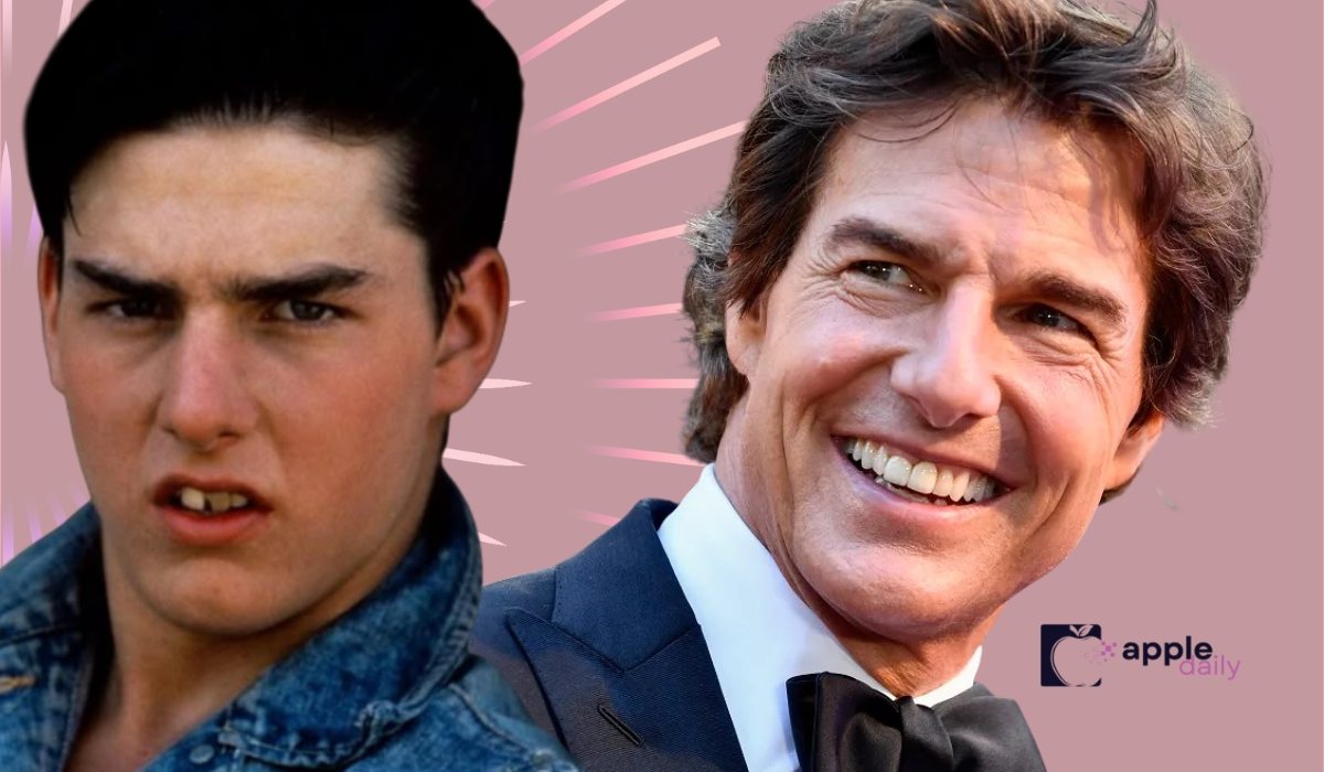 Side by side comparison of Tom Cruise in his younger years and later in life, highlighting changes in his smile and teeth
