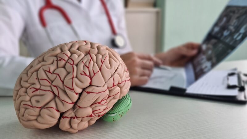 A brain model sits on a desk as a doctor reviews a CT scan
