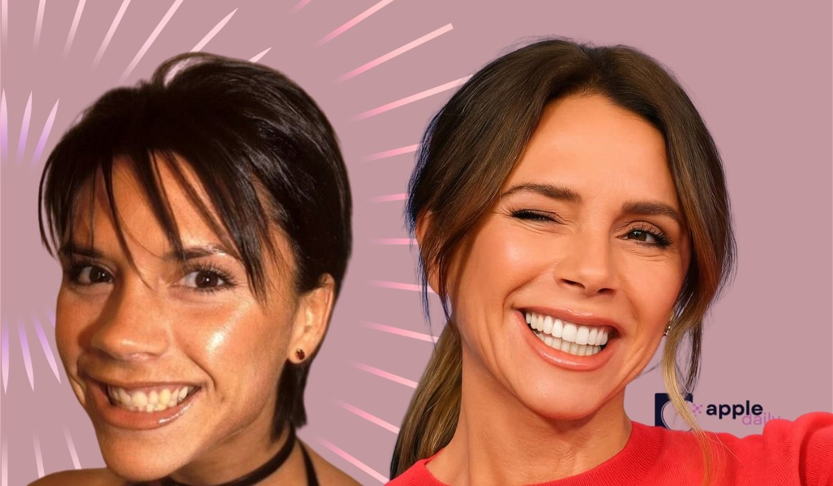 Side by side images of Victoria Beckham from her early career and later years, showing changes in her smile and dental appearance